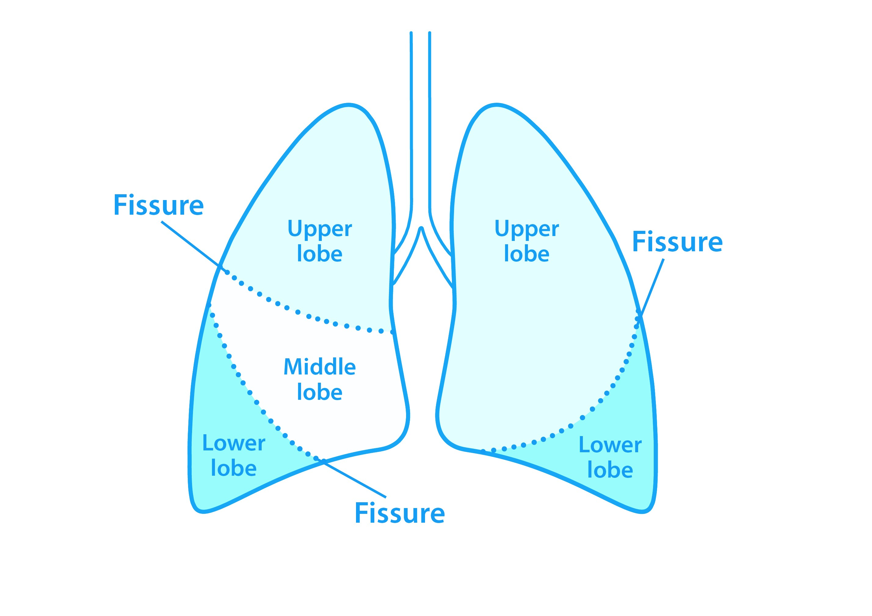 lung-volume-reduction-procedures-asthma-lung-uk